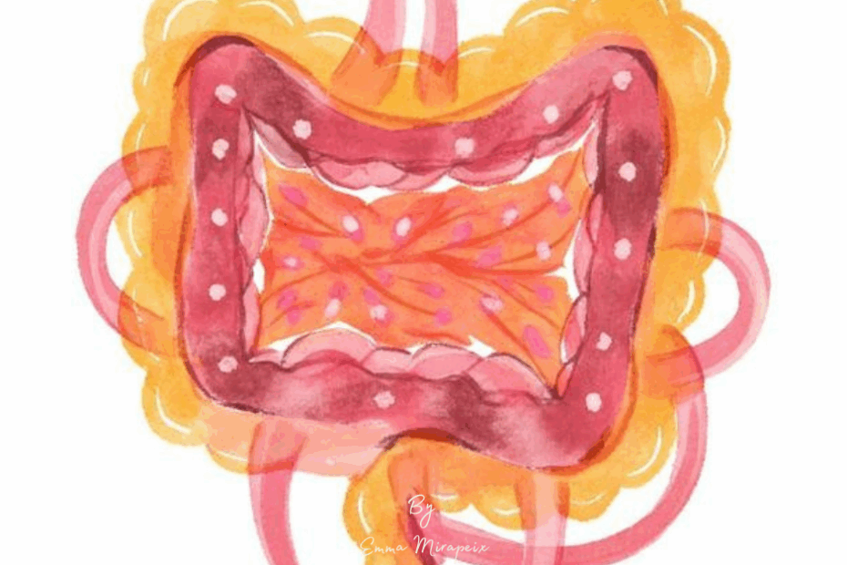 Intestino permeablilidad intestinal Emma Mirapeix